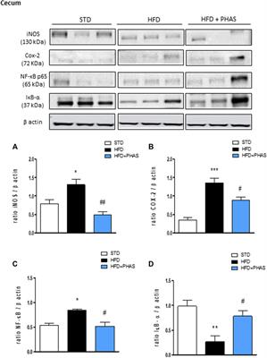 Phaseolus vulgaris extract ameliorates high-fat diet-induced <mark class="highlighted">colonic barrier</mark> dysfunction and inflammation in mice by regulating peroxisome proliferator-activated receptor expression and butyrate levels